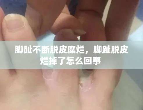 腳趾不斷脫皮糜爛，腳趾脫皮爛掉了怎么回事 