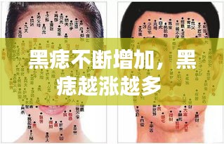 黑痣不斷增加，黑痣越漲越多 
