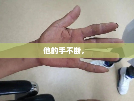 他的手不斷， 