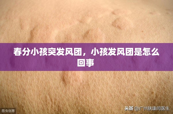 春分小孩突發(fā)風團，小孩發(fā)風團是怎么回事 
