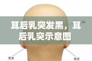 耳后乳突發(fā)黑，耳后乳突示意圖 