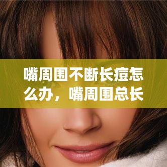 嘴周圍不斷長痘怎么辦，嘴周圍總長痘痘怎么辦 