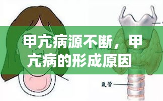 甲亢病源不斷，甲亢病的形成原因 