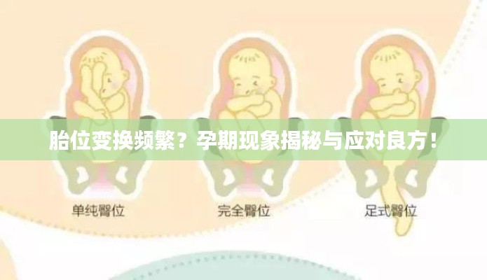 胎位變換頻繁？孕期現(xiàn)象揭秘與應(yīng)對良方！