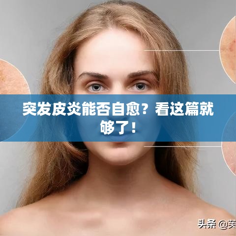 突發(fā)皮炎能否自愈？看這篇就夠了！