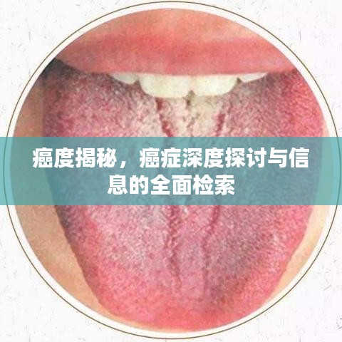 癌度揭秘，癌癥深度探討與信息的全面檢索