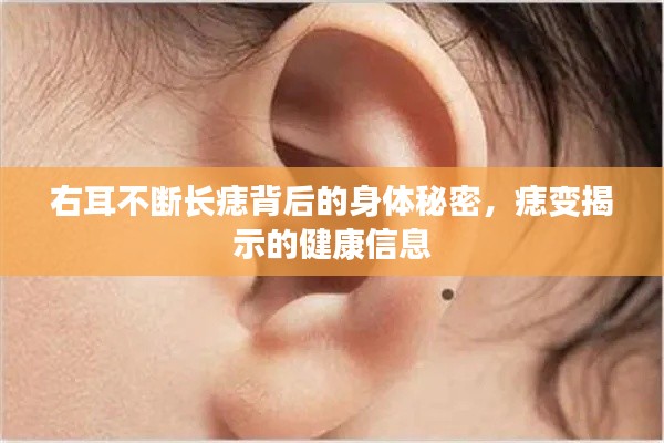 右耳不斷長痣背后的身體秘密，痣變揭示的健康信息